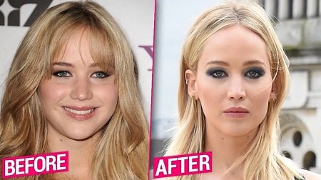 A picture of Jennifer Lawrence before (left) and after (right).
